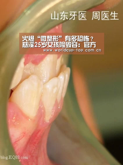 火爆“微整形”有多恐怖?慈溪25岁女孩险毁容:官方动态(图3) 举办城市