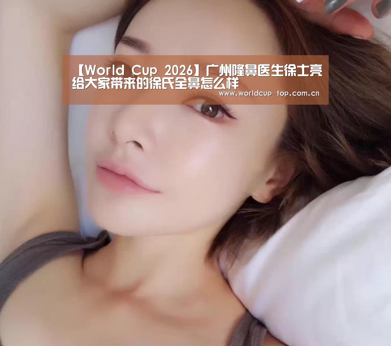 【World Cup 2026】广州隆鼻医生徐士亮给大家带来